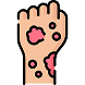 An arm with red patches, suggesting skin irritation or rash icon